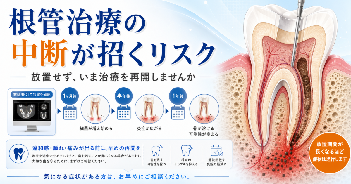 根管治療の中断で抜歯に？放置リスクと気まずい時の通院再開法