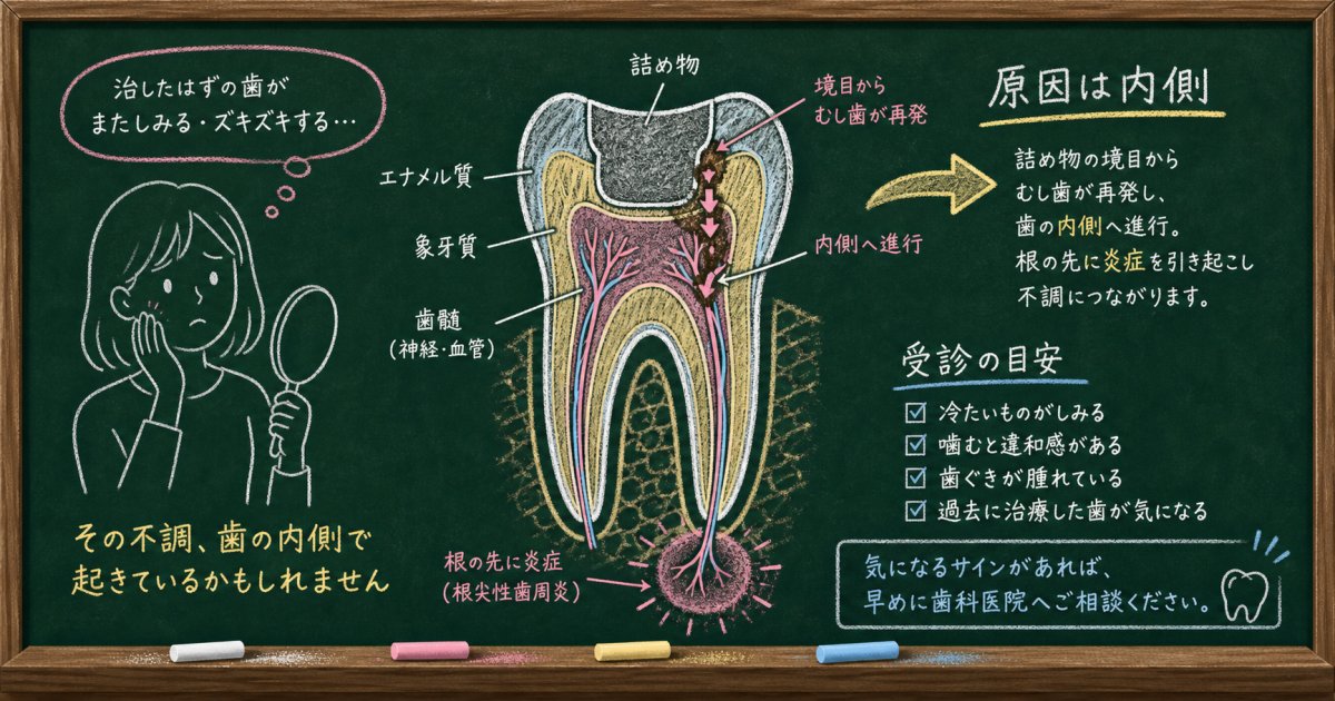 治療した歯が何度も痛むのはなぜ？原因と受診すべき目安を解説