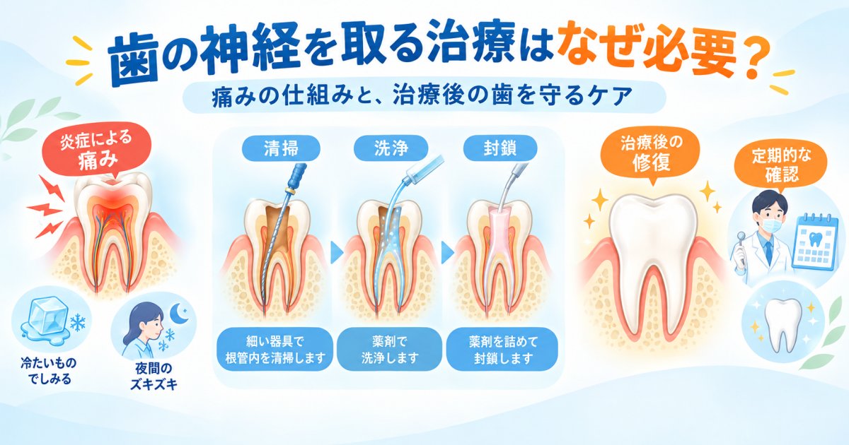 歯の神経を取る治療はなぜ必要？痛みの仕組みと治療後の歯への影響